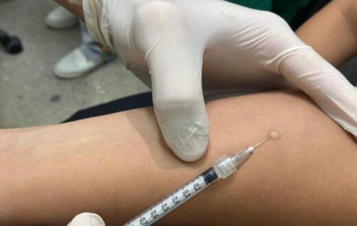 Tratamento preventivo contra tuberculose pode durar três meses em Manaus